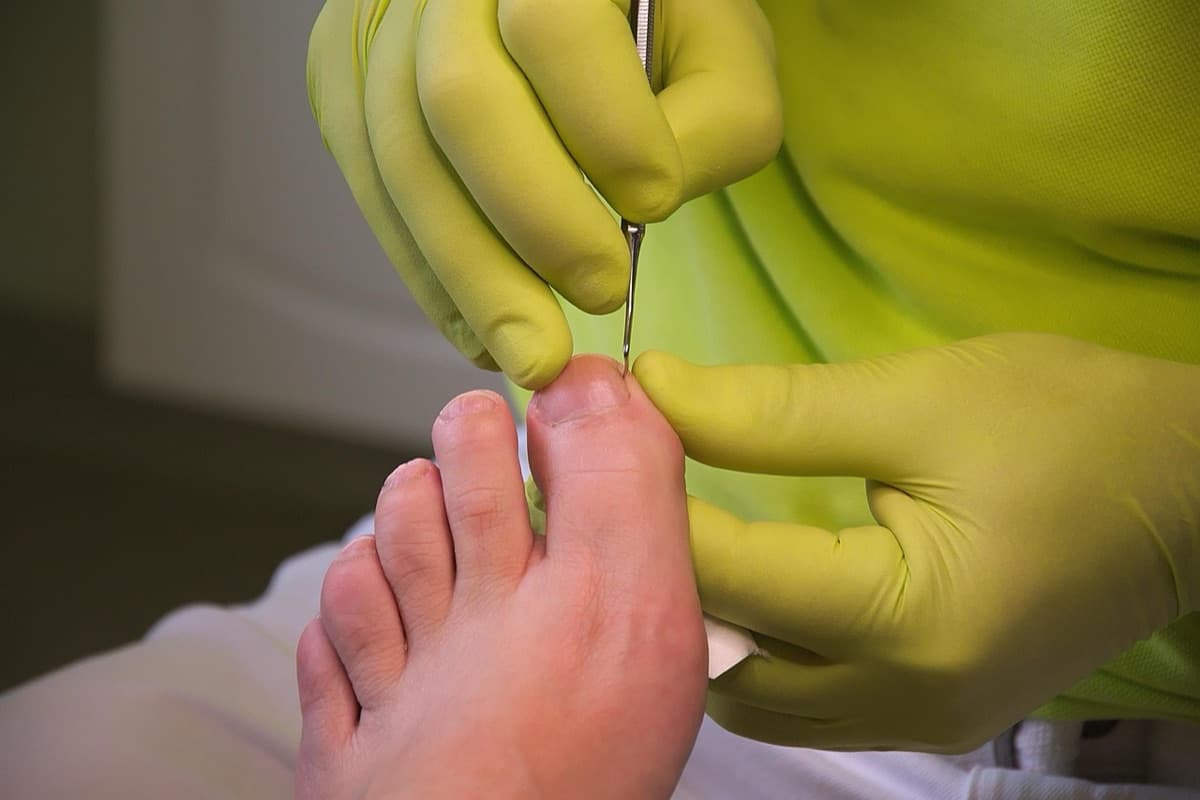 Professional foot care treatment
